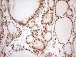 MGMT Antibody in Immunohistochemistry (Paraffin) (IHC (P))