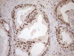 MGMT Antibody in Immunohistochemistry (Paraffin) (IHC (P))