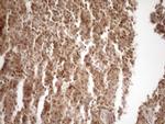 MGMT Antibody in Immunohistochemistry (Paraffin) (IHC (P))