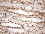 MGMT Antibody in Immunohistochemistry (Paraffin) (IHC (P))