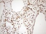 MGMT Antibody in Immunohistochemistry (Paraffin) (IHC (P))