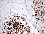 MGMT Antibody in Immunohistochemistry (Paraffin) (IHC (P))