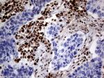 MGMT Antibody in Immunohistochemistry (Paraffin) (IHC (P))