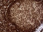 MGMT Antibody in Immunohistochemistry (Paraffin) (IHC (P))