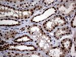 MGMT Antibody in Immunohistochemistry (Paraffin) (IHC (P))