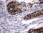 MGMT Antibody in Immunohistochemistry (Paraffin) (IHC (P))