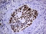 MGMT Antibody in Immunohistochemistry (Paraffin) (IHC (P))