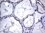 MGMT Antibody in Immunohistochemistry (Paraffin) (IHC (P))