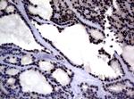 MGMT Antibody in Immunohistochemistry (Paraffin) (IHC (P))