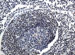 MGMT Antibody in Immunohistochemistry (Paraffin) (IHC (P))