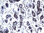 MGMT Antibody in Immunohistochemistry (Paraffin) (IHC (P))