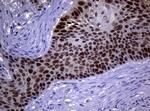 MGMT Antibody in Immunohistochemistry (Paraffin) (IHC (P))