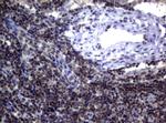 MGMT Antibody in Immunohistochemistry (Paraffin) (IHC (P))