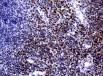 MGMT Antibody in Immunohistochemistry (Paraffin) (IHC (P))