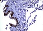 MGMT Antibody in Immunohistochemistry (Paraffin) (IHC (P))