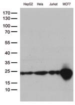 MGMT Antibody in Western Blot (WB)