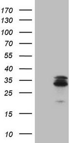 MGMT Antibody in Western Blot (WB)