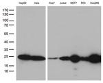 MGMT Antibody in Western Blot (WB)