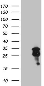 MGMT Antibody in Western Blot (WB)