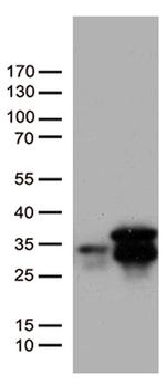 MGMT Antibody in Western Blot (WB)