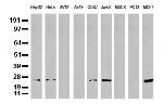 MGMT Antibody in Western Blot (WB)