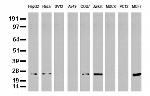 MGMT Antibody in Western Blot (WB)