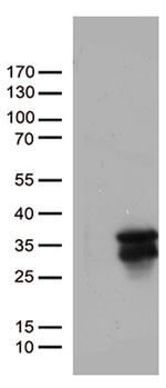 MGMT Antibody in Western Blot (WB)