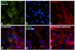 Apolipoprotein B Antibody