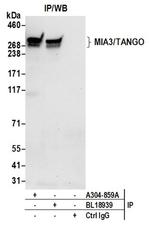 MIA3/TANGO Antibody in Western Blot (WB)