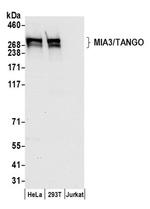 MIA3/TANGO Antibody in Western Blot (WB)