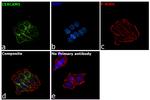 CEA Antibody in Immunocytochemistry (ICC/IF)