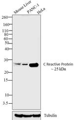 CRP Antibody in Western Blot (WB)