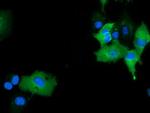 MICAL1 Antibody in Immunocytochemistry (ICC/IF)