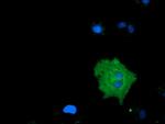 MICAL1 Antibody in Immunocytochemistry (ICC/IF)