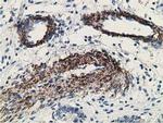 MICAL1 Antibody in Immunohistochemistry (Paraffin) (IHC (P))