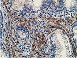 MICAL1 Antibody in Immunohistochemistry (Paraffin) (IHC (P))