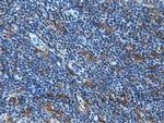 MICAL1 Antibody in Immunohistochemistry (Paraffin) (IHC (P))