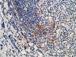 MICAL1 Antibody in Immunohistochemistry (Paraffin) (IHC (P))