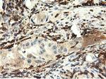 MICAL1 Antibody in Immunohistochemistry (Paraffin) (IHC (P))