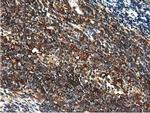 MICAL1 Antibody in Immunohistochemistry (Paraffin) (IHC (P))