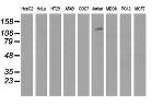 MICAL1 Antibody in Western Blot (WB)