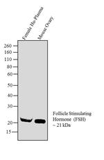 Follicle Stimulating Hormone Antibody in Western Blot (WB)