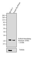 Follicle Stimulating Hormone Antibody in Western Blot (WB)