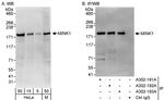 MINK1 Antibody in Western Blot (WB)