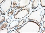 MIOX Antibody in Immunohistochemistry (Paraffin) (IHC (P))