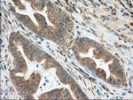 MIOX Antibody in Immunohistochemistry (Paraffin) (IHC (P))