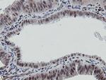 MIPEP Antibody in Immunohistochemistry (Paraffin) (IHC (P))