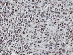 MIPEP Antibody in Immunohistochemistry (Paraffin) (IHC (P))