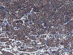 MIPEP Antibody in Immunohistochemistry (Paraffin) (IHC (P))