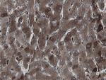 MIPEP Antibody in Immunohistochemistry (Paraffin) (IHC (P))